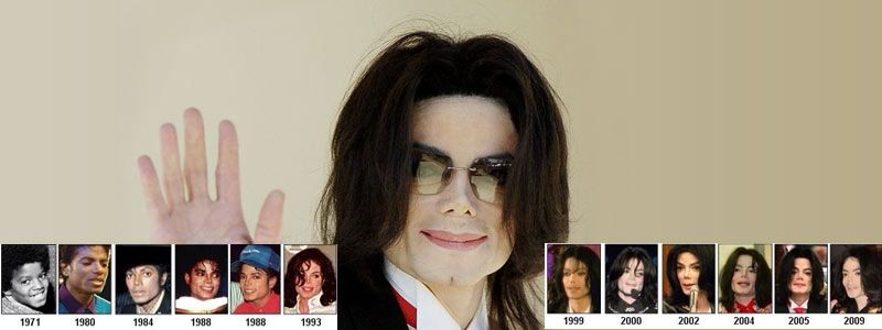Changing Face of Michael Jackson | Dubai Cosmetic Surgery®
